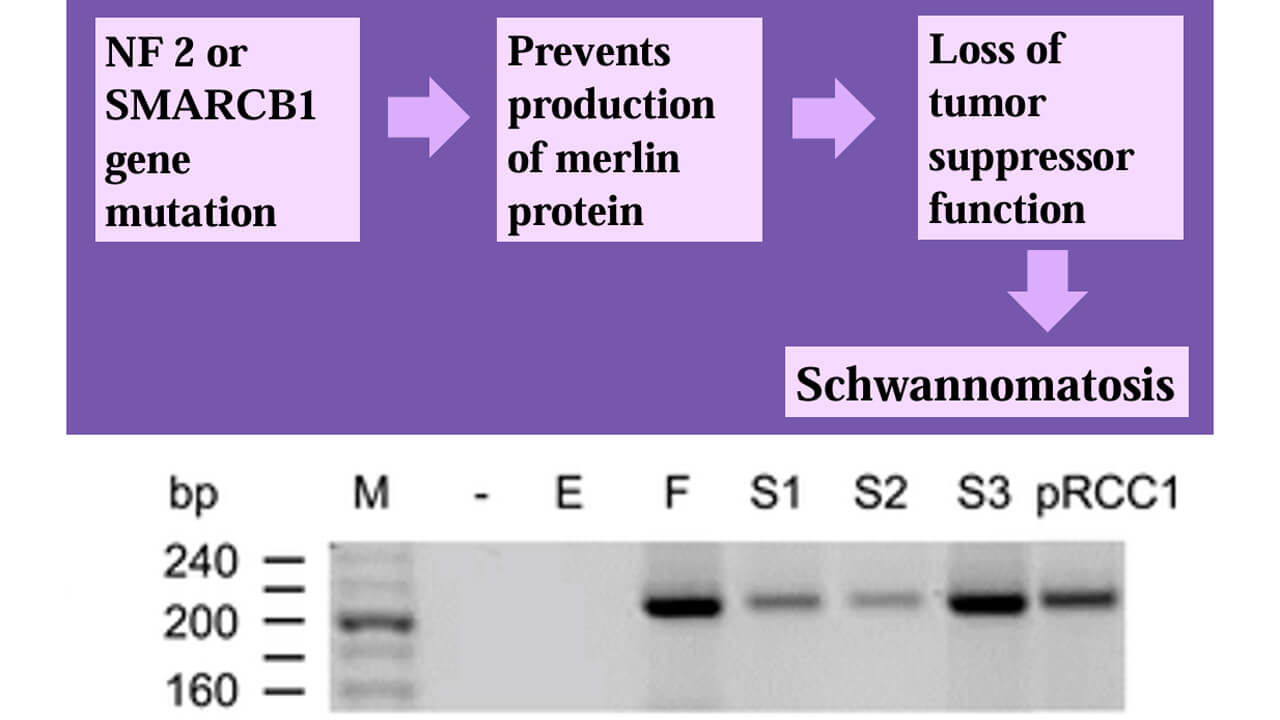 Graphic depicting the genetics of RCC and schwannoma